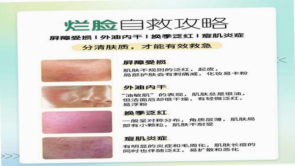 幻颜宝常见问题